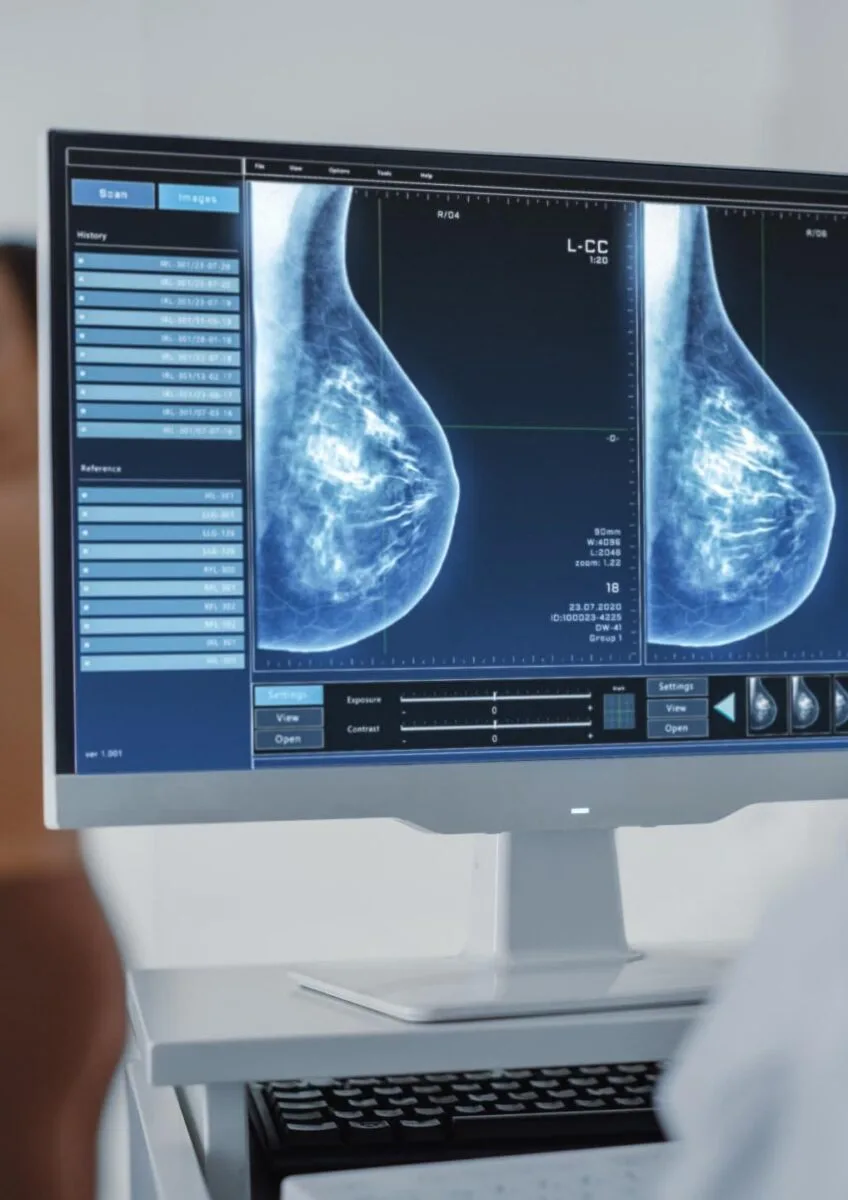 Clinician reviewing breast screening scans