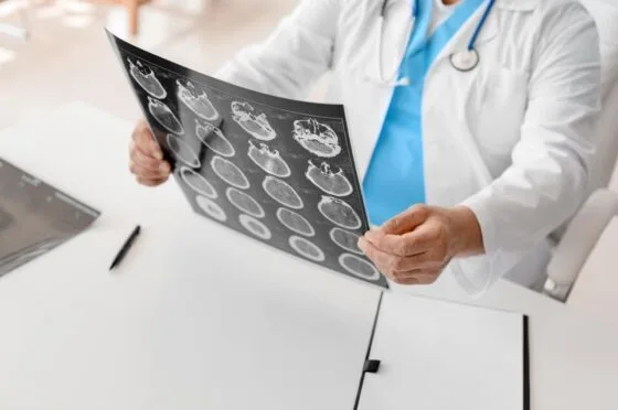 Doctor reviewing brain scan films