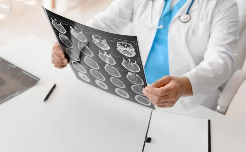 Doctor reviewing brain scan films