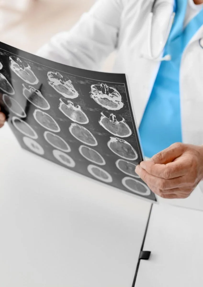 Doctor reviewing brain scan films