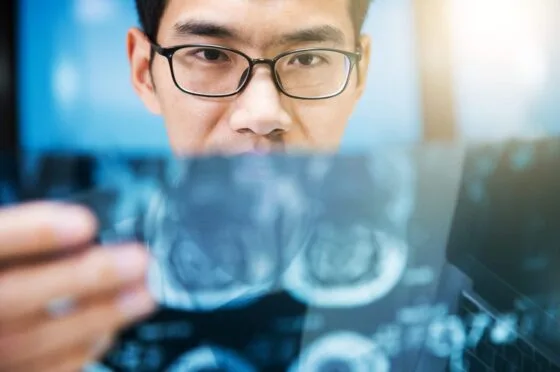 Doctor reviewing X-ray image