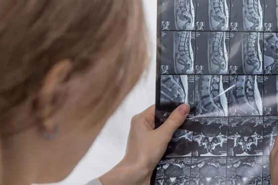 Medical professional reviewing spinal MRI scan