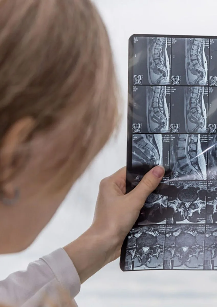 Medical professional reviewing spinal MRI scan