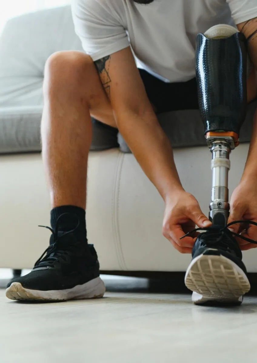 Person with prosthetic leg tying shoelace
