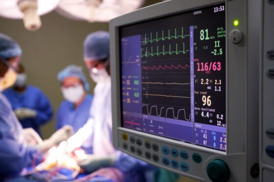 Patient monitor displaying vital signs during heart surgery