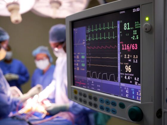 Patient monitor displaying vital signs during heart surgery