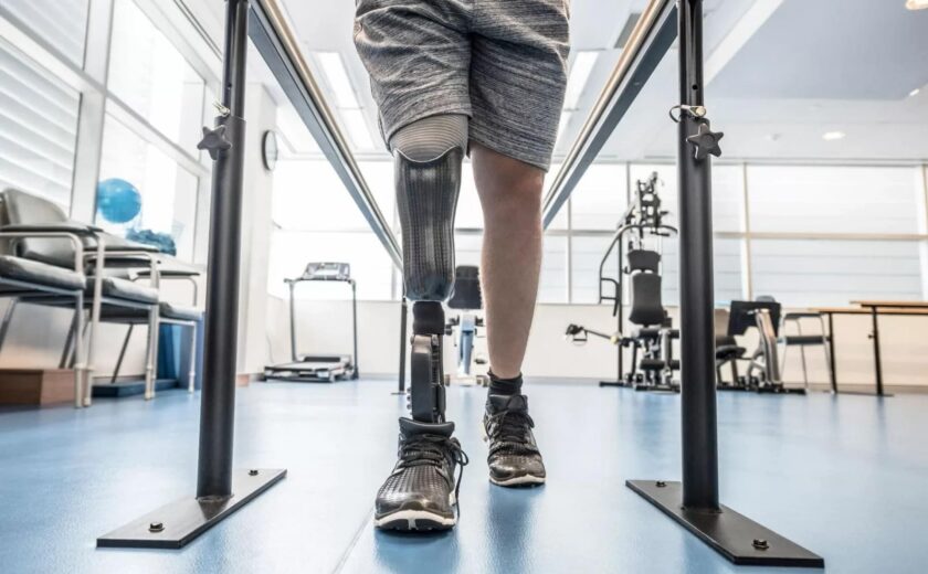 Amputee walking with prosthetic leg in gym