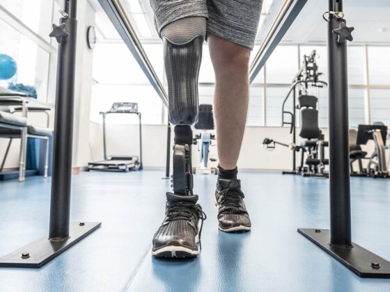 Amputee walking with prosthetic leg in rehabilitation gym