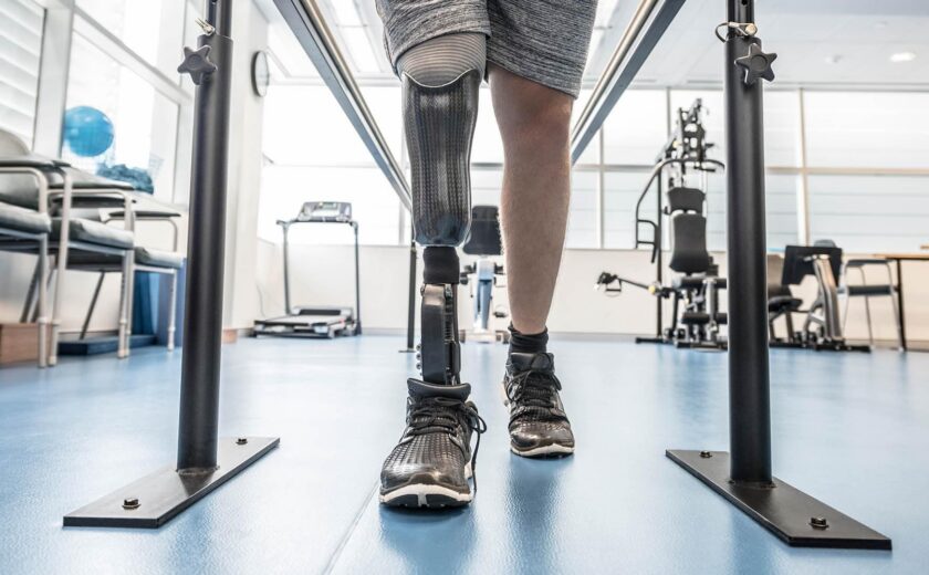Amputee walking with prosthetic leg in rehabilitation gym