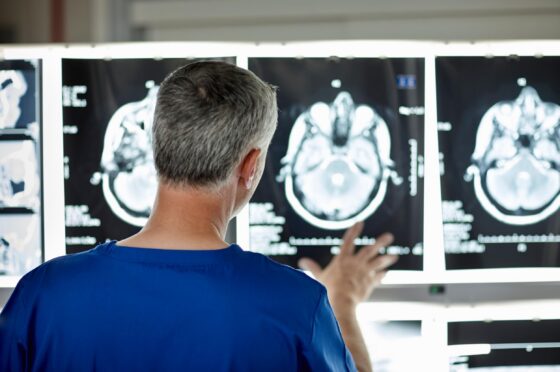 Clinician reviewing brain scans on lightbox