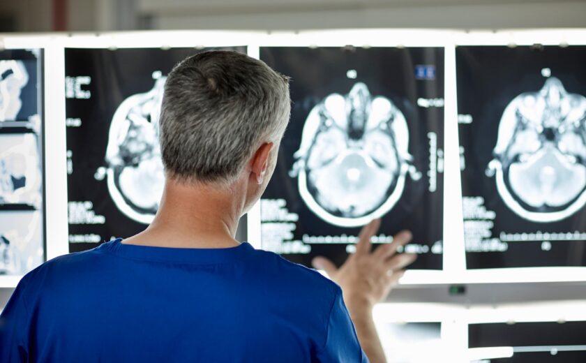 Clinician reviewing brain scans on lightbox