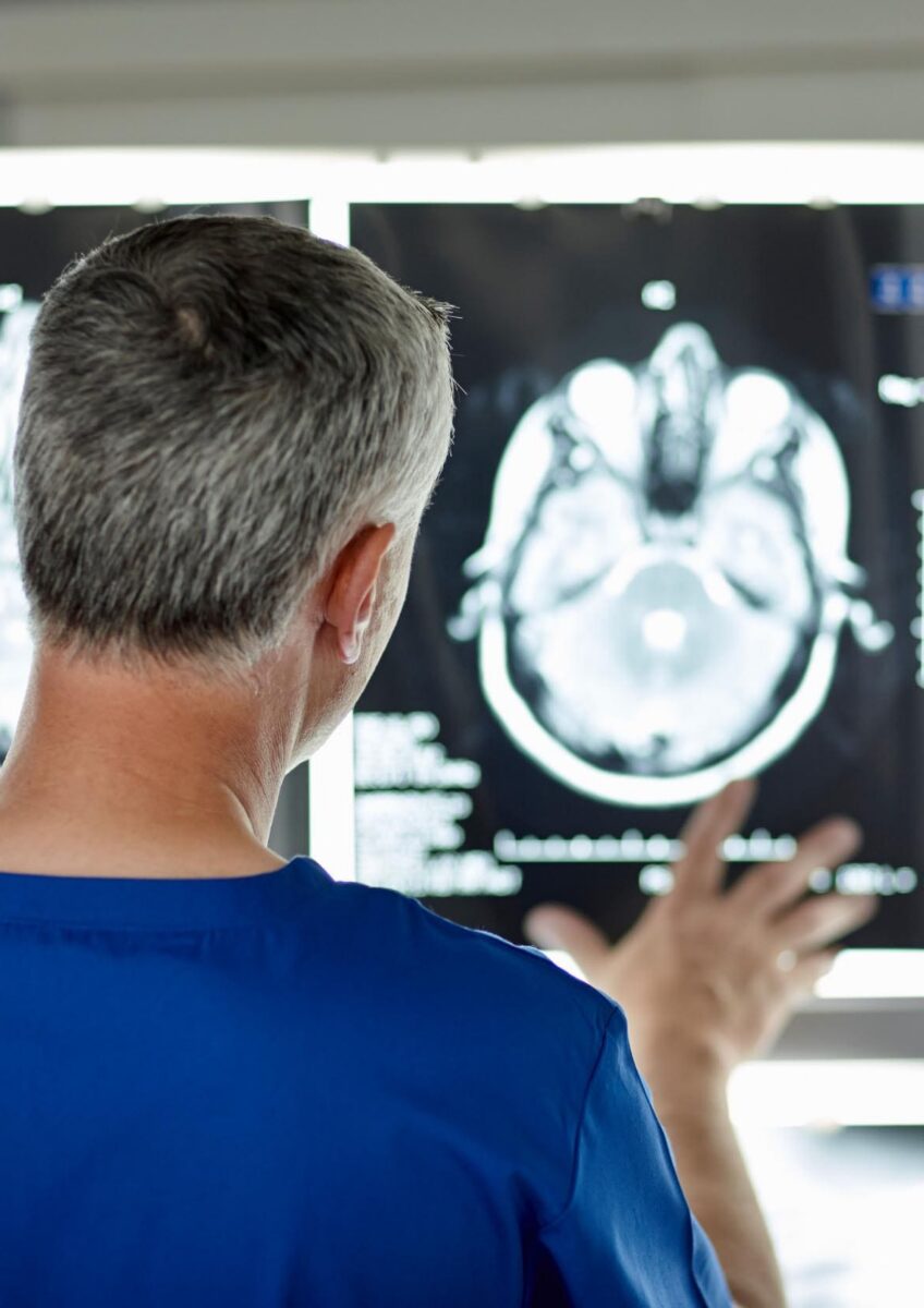 Clinician reviewing brain scans on lightbox