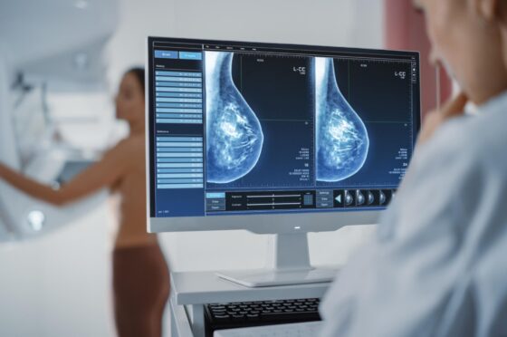 Clinician reviewing breast screening scans