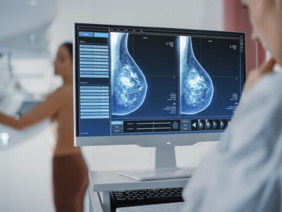 Clinician reviewing breast screening scans