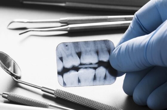 Dentist holding dental X-ray