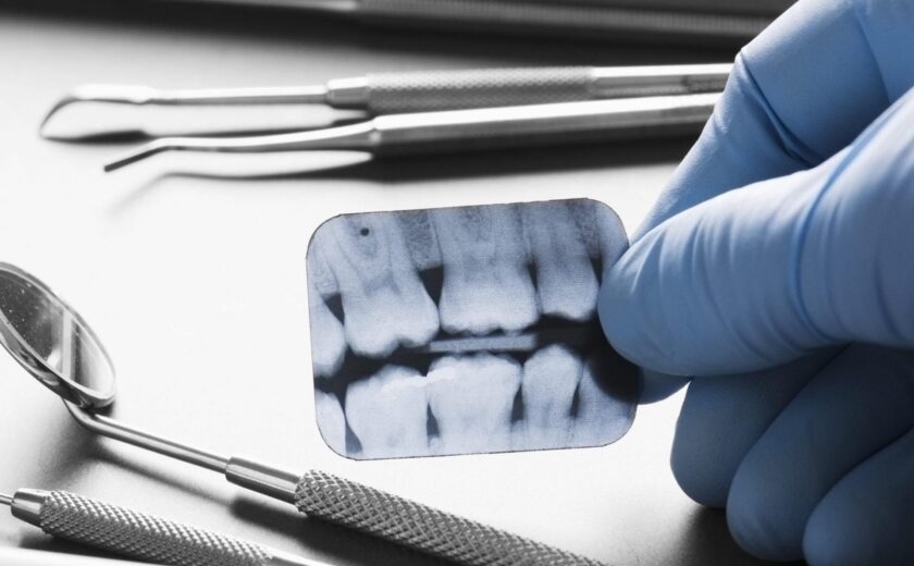 Dentist holding dental X-ray