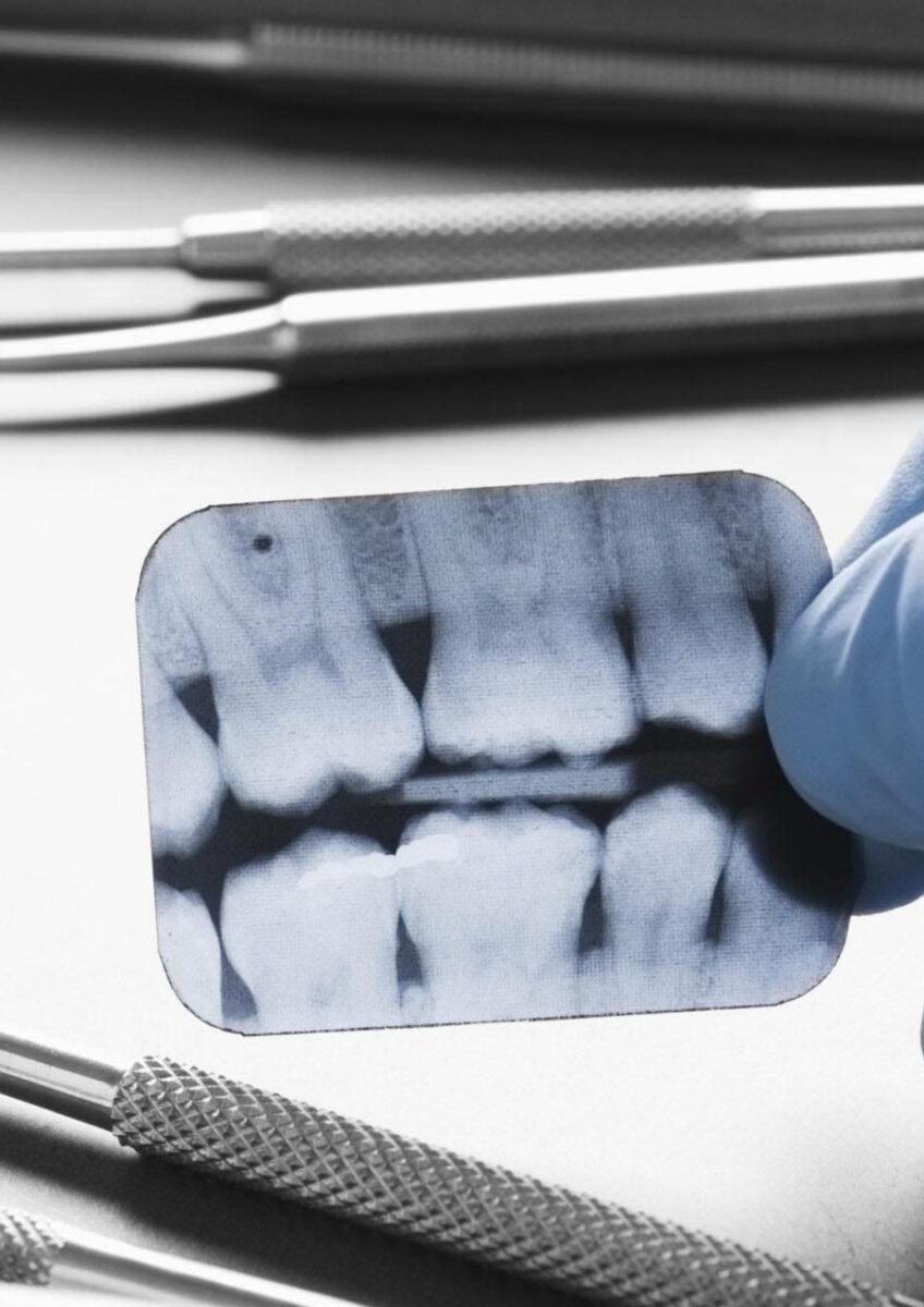 Dentist holding dental X-ray