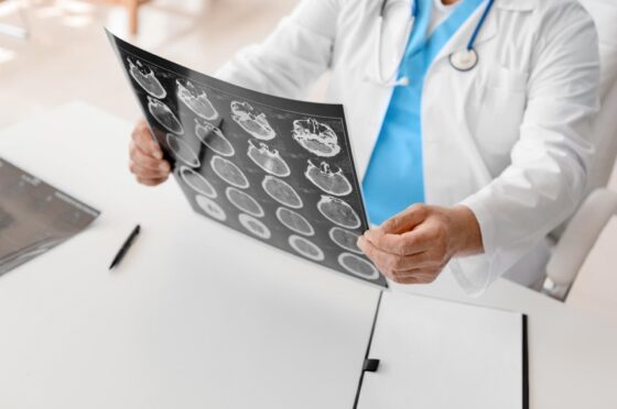Doctor reviewing brain scan films