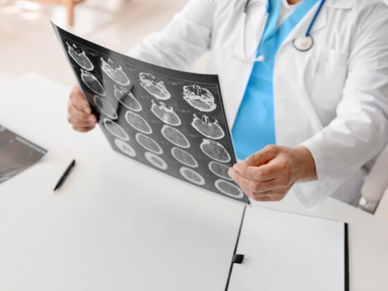 Doctor reviewing brain scan films