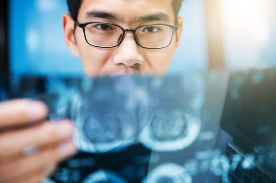 Doctor reviewing X-ray image