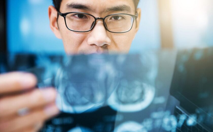 Doctor reviewing X-ray image