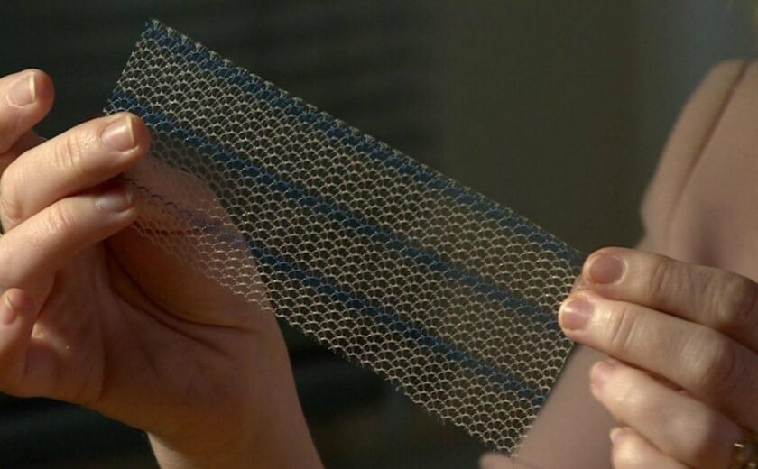 Hands holding surgical mesh implant sample