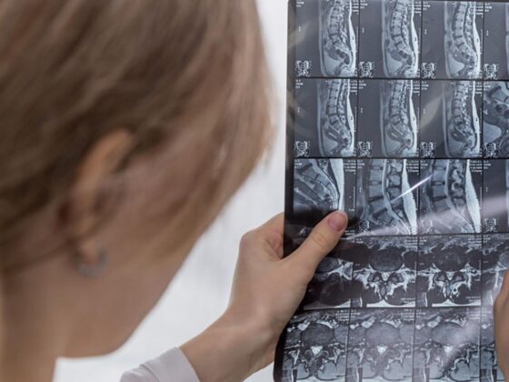 Medical professional reviewing spinal MRI scan