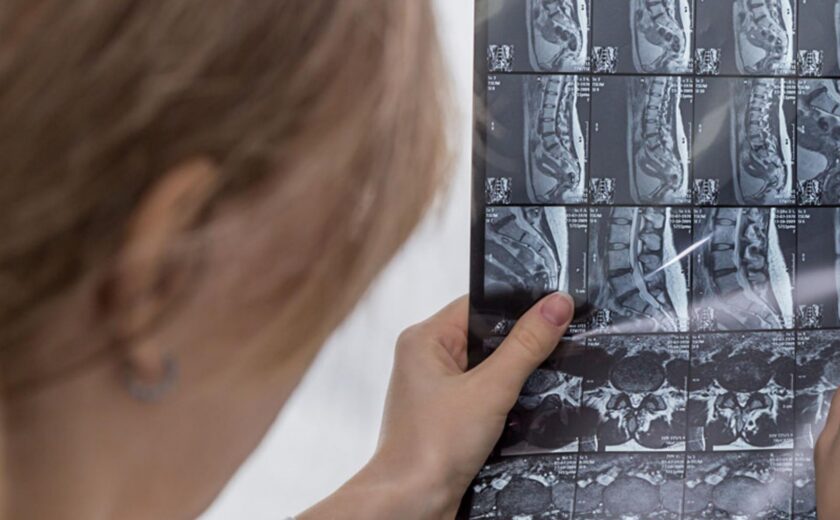 Medical professional reviewing spinal MRI scan