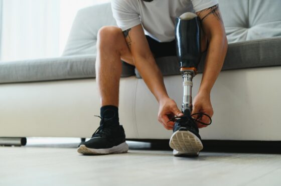 Person with prosthetic leg tying shoelace