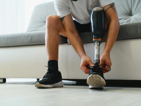 Person with prosthetic leg tying shoelace