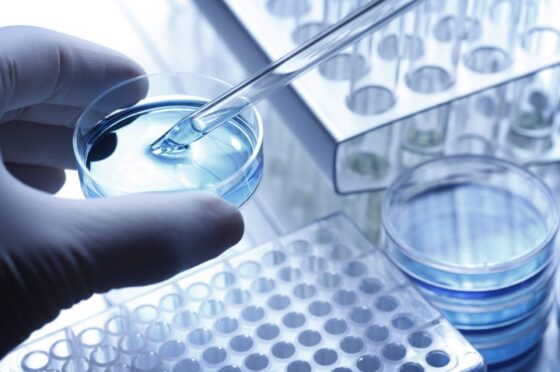 Pipette testing sample in laboratory