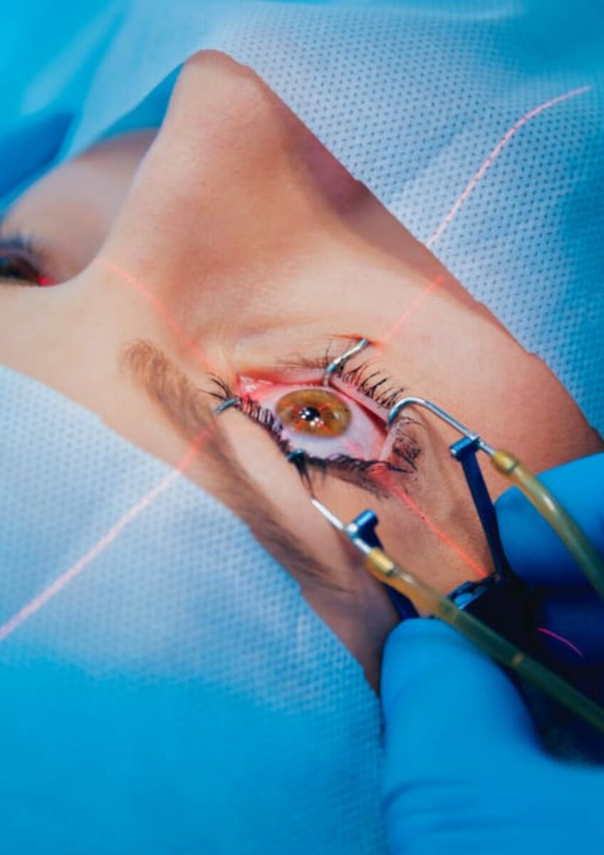 Patient undergoing eye surgery with eyelid held open and laser targeting eye